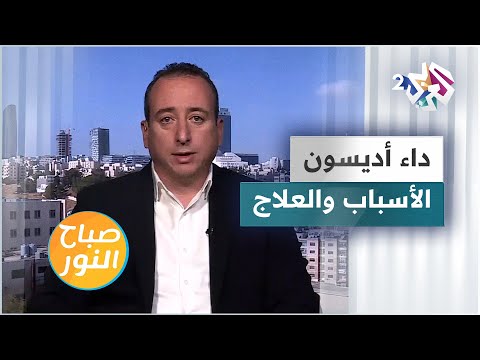داء اديسون الأسباب والأعراض والعلاج
