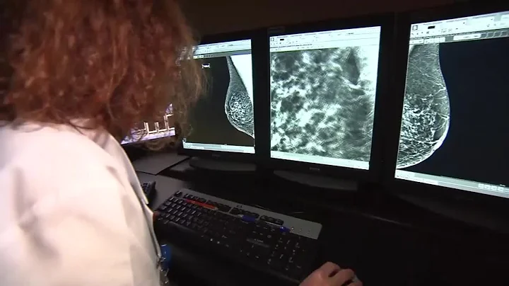 FDA Sets New Mammogram Guidelines To Protect Women