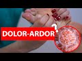 DOLOR Y ardor de pies, desinflamante natural con sal #dolor #pies