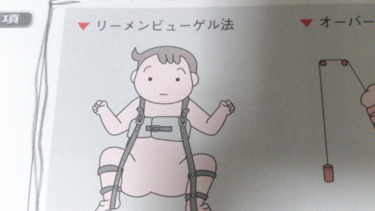 看護学生講座 132 小児 ｢先天性股関節脱臼 よく問われるポイント