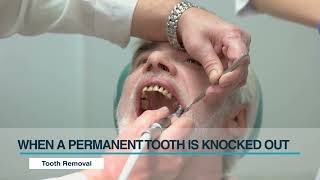 Dental Corner: When a Permanent Tooth Is Knocked Out