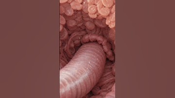 Life of a Tapeworm | Animated Science