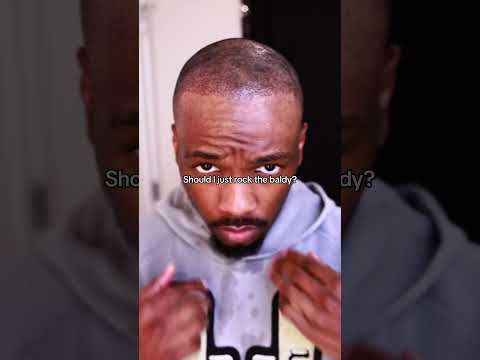 Should I Rock The Baldy