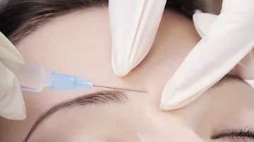 ¿Cuánto tarda el Botox en asentarse?