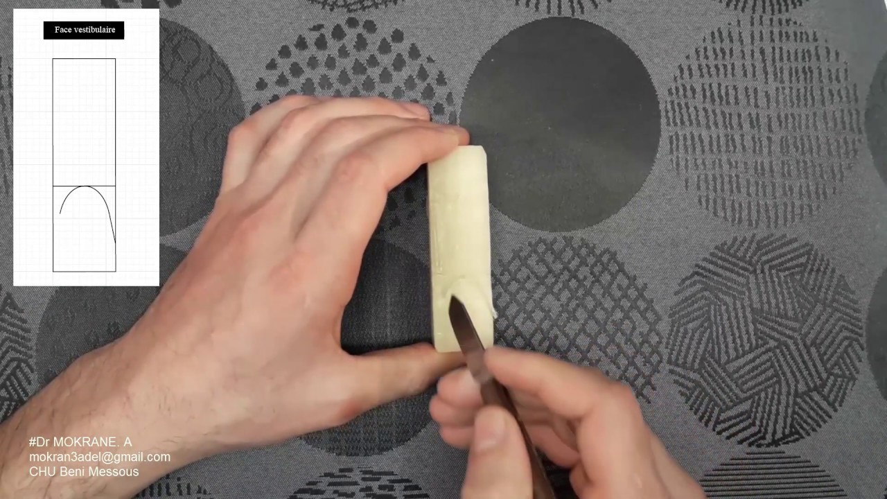 Démonstration en temps réel: Sculpture de la Canine Supérieure Gauche (Partie 01: Ébauche)