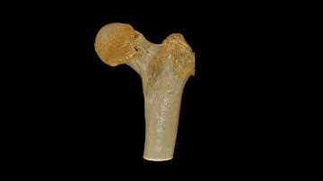 Time-lapsed images of one specimen loaded to fracture