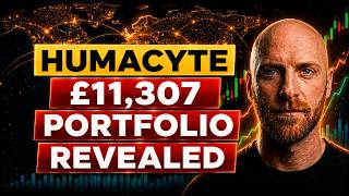 Full Humacyte Portfolio Revealed And Why I'm Still Holding HUMA