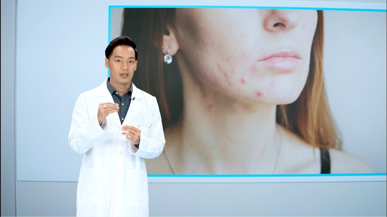 ဝက်ခြံပေါက်တဲ့အခါမှာ ဘယ်လိုဖြေရှင်းကြမလဲ | Health Fix | MRTV-4