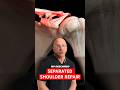Can Surgery Fix A Separated Shoulder Shorts 