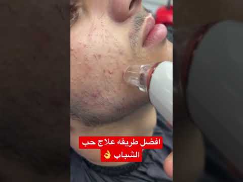 فيديو: متى تنظف ناشر الشباب؟