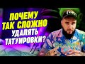 Почему так сложно удалить татуировку? / Всё, что нужно знать про удаление татуировок!