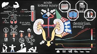 understanding acute kidney injury