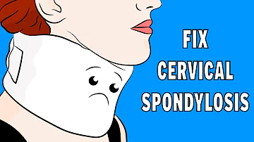 Che cos'è una spondilite?