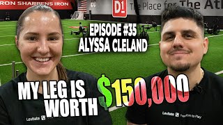 My Leg is Worth 150k Alyssa Cleland Interview