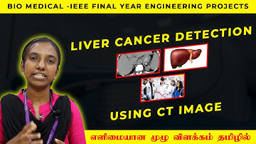 Cancer Detection Using CT Images | Matlab Projects | IEEE Projects | தமிழில்  | in Tamil