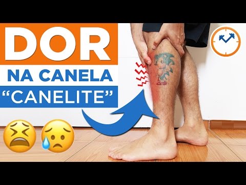 CANELITE: DOR NA