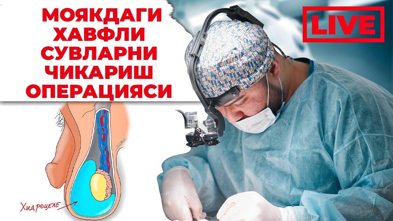 Тухумдаги сувни операция килиб олиб ташлаймиз Гидроцеле, Бергмана - YouTube