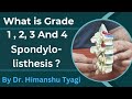 Spondylolisthesis grade 1234