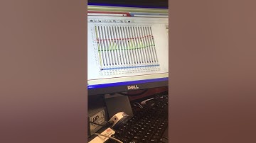 Cochlear Implant Mapping Part 3