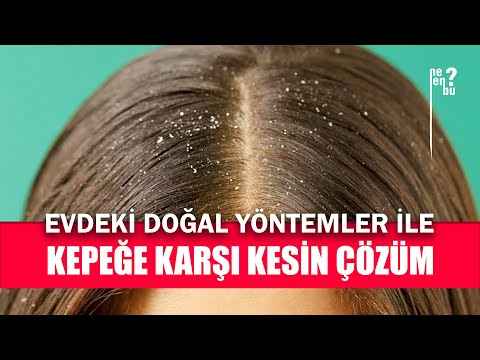 Kepek Nasıl Geçer ve Kepekli Saça Ne İyi Gelir? - Evdeki Malzemelerle Doğal Çözümler