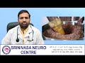Cooking Oils for Healthy living | Explained by Dr. Ghanta Srinivas | Best Neurologist in Guntur