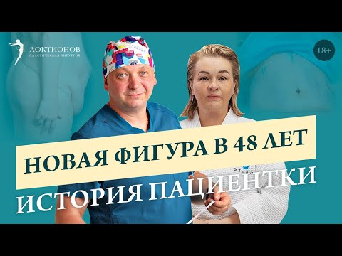 Убираем фартук на животе после 2 родов и похудения? // История пациентки // 18+