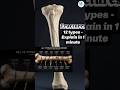 ๐ฅ ๐๐ ๐๐๐๐๐ ๐๐
๐
๐๐๐๐๐๐๐๐ ๐ฆด๐๐๐ ๐๐๐๐ ๐๐๐๐!#orthopedics #fracture #youtubeshorts #youtubefeeds #shorts