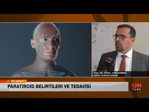 İŞİN UZMANI/ PARATİROİD BELİRTİLERİ VE TEDAVİSİ/ DOÇ. DR. İSMAİL CEM SORMAZ (16 TEMMUZ 2023)