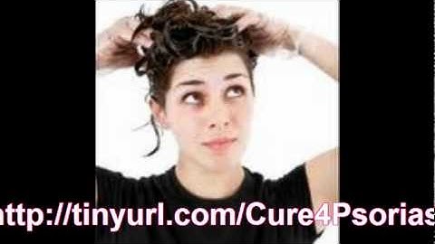 Psoriasis Triggers : What Triggers Psoriasis Flare-ups