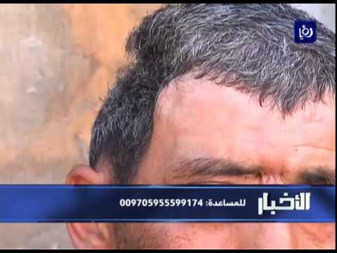 أسامة بسيسو احد ضحايا الاحتلال الاسرائيلي يعاني ظروف معيشية صعبة