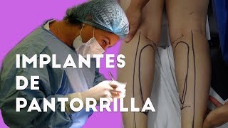 Operadas pantorrillas