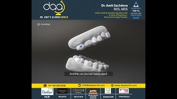 The future of your Teens Smile |  Invisalign