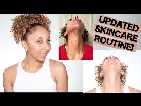 Updated Day & Night Skincare Routine! Acne Prone Skin | BiancaReneeToday