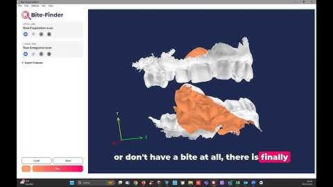 Bite-Finder in a nutshell: AI Solution for a new standard of dental care.