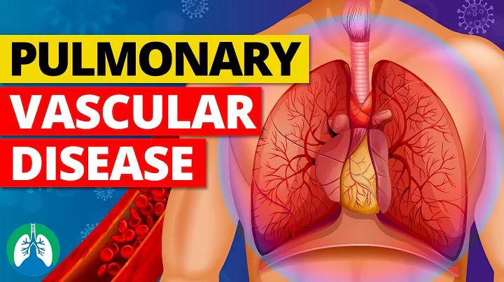 Pulmonary Vascular Disease (Medical Definition) | Quick Explainer Video - DayDayNews