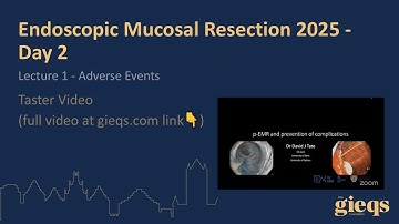 Lecture 1 - Adverse Events (Taster Video)