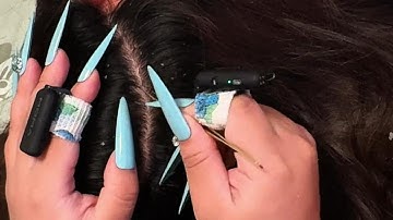 May’s ASMR Scalp Therapy — Gentle Tweezer Details for Deep Calm | No Talking