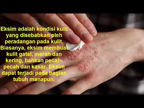 Cara mengobati Eksim dengan Daun Mahkota Dewa