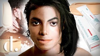 Почему Кожа Майкла Джексона Побелела? Был Ли Это Его Выбор?