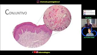 Connective Tissue