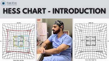 Hess Chart - Introduction