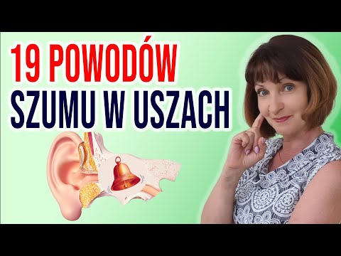 Wideo: Jak znaleźć przyczyny szumów usznych: 10 kroków (ze zdjęciami)