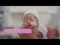 Premature baby  nutrition and feeding