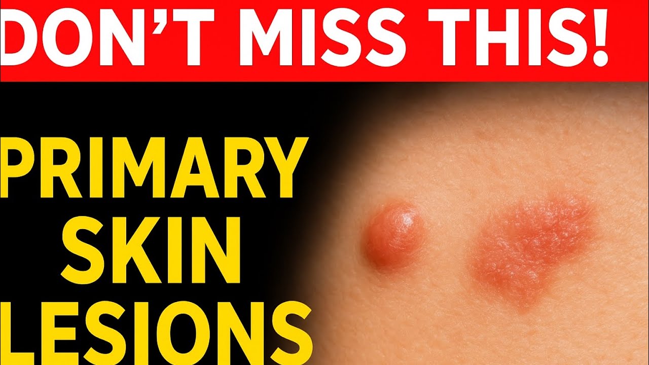 🔥 Learn Primary Skin Lesions in just minutes! 