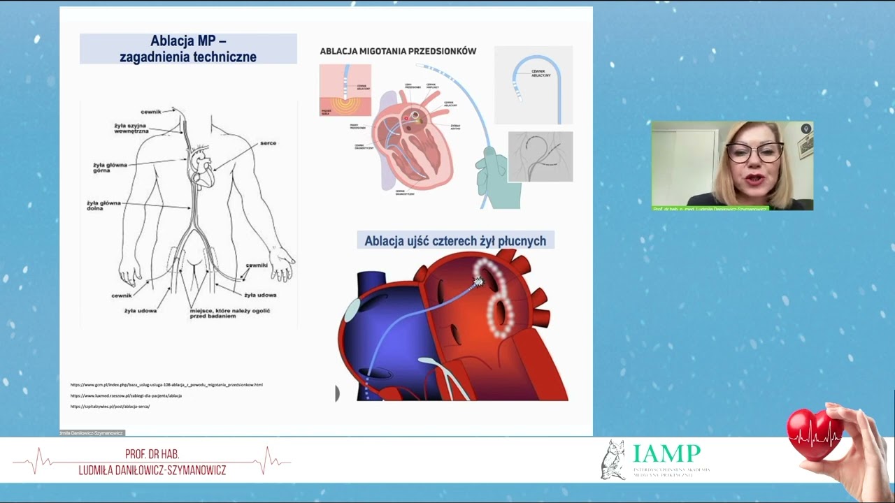 Migotanie przedsionków – lepiej leczyć farmakologicznie czy zabiegowo