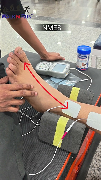 Neuromuscular electrical stimulation for faster recovery. #physiotherapist #physio