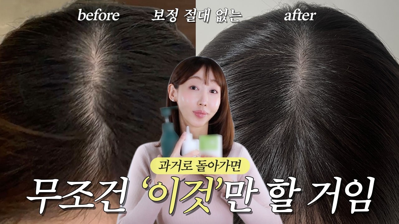 15년차 탈모 인생…👩🏻‍🦲 다시 20살로 돌아간다면 ‘이렇게’ 할 것임❗후회하는 것 vs 무조건 할 것 top3 알려드림