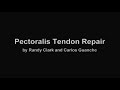 Pectoralis Major Tendon Repair