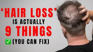 You're Thinking About Hair Loss All Wrong