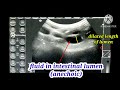 colic and intestinal obstruction in dog/ultrasound findings of intestinal(bowel) obstruction in dog